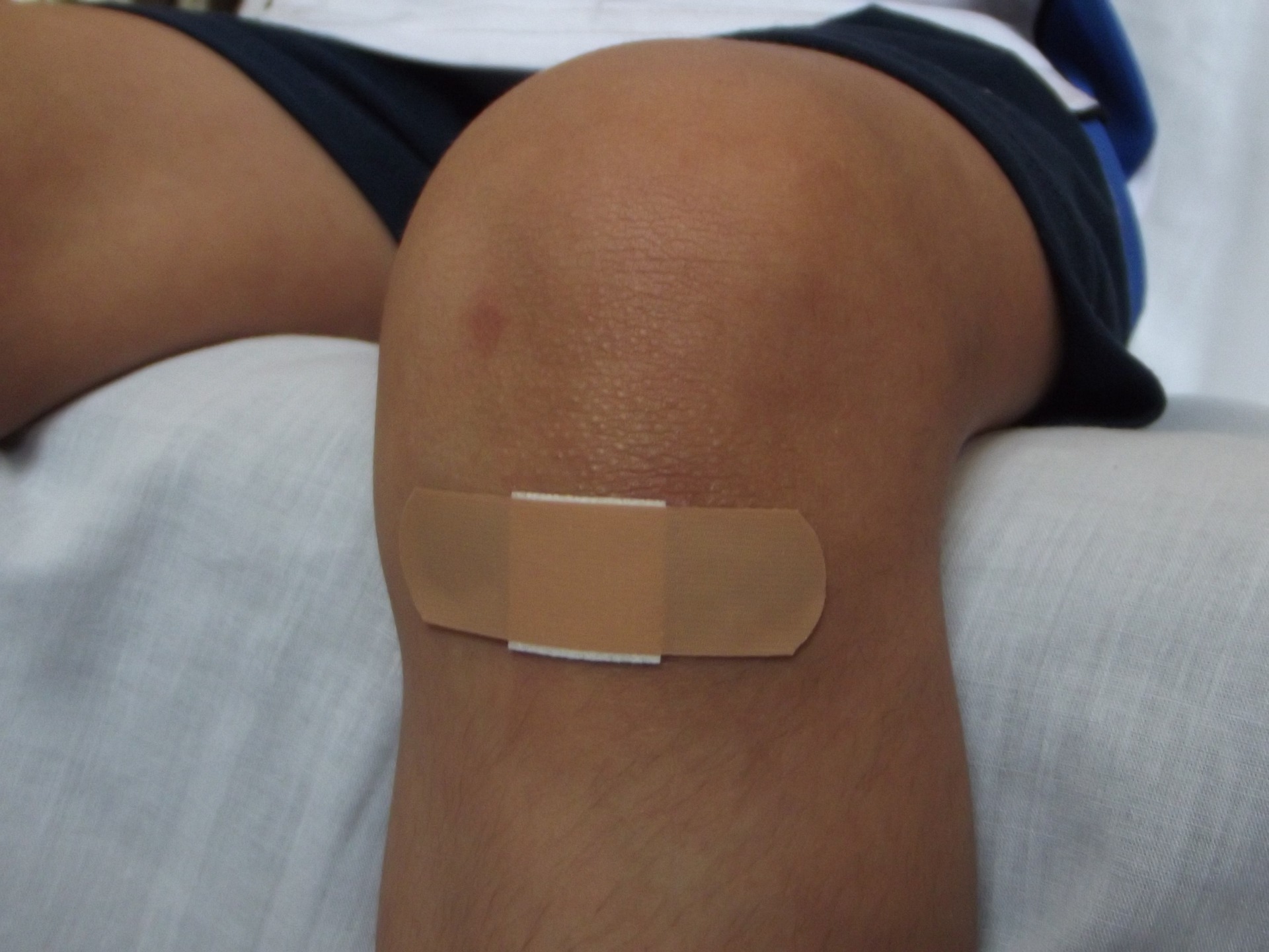 Injury Stock Photo