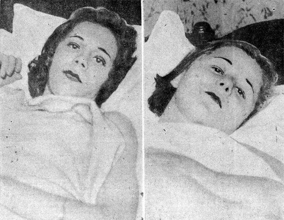Two girl employees of the RCA Victor Company, Miss Clara Schaeffer and Miss Violetta Brown, confined to their beds after receiving treatment at Cooper Hospital for ptomaine poisoning